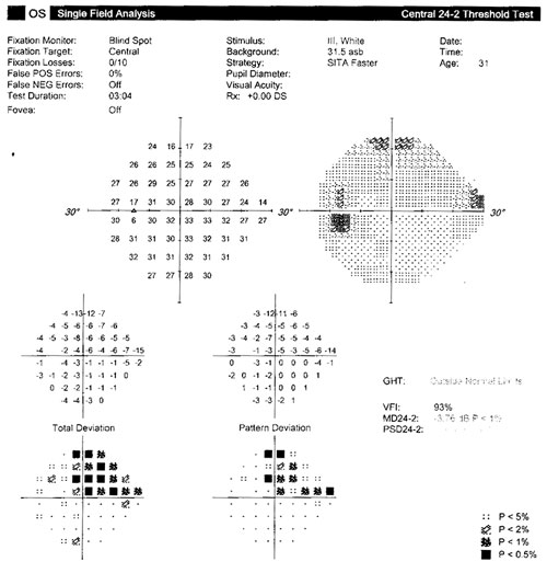 Optometry case study – OCT clinical indicators for functional testing ...